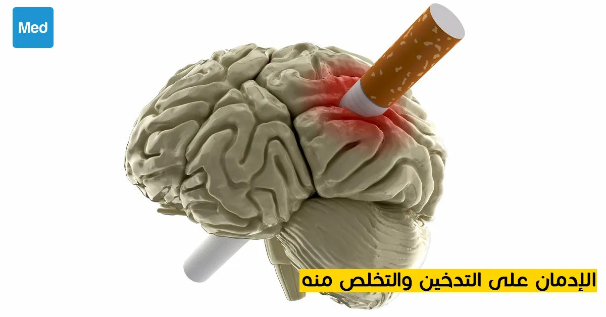 الإدمان على التدخين والتخلص منه